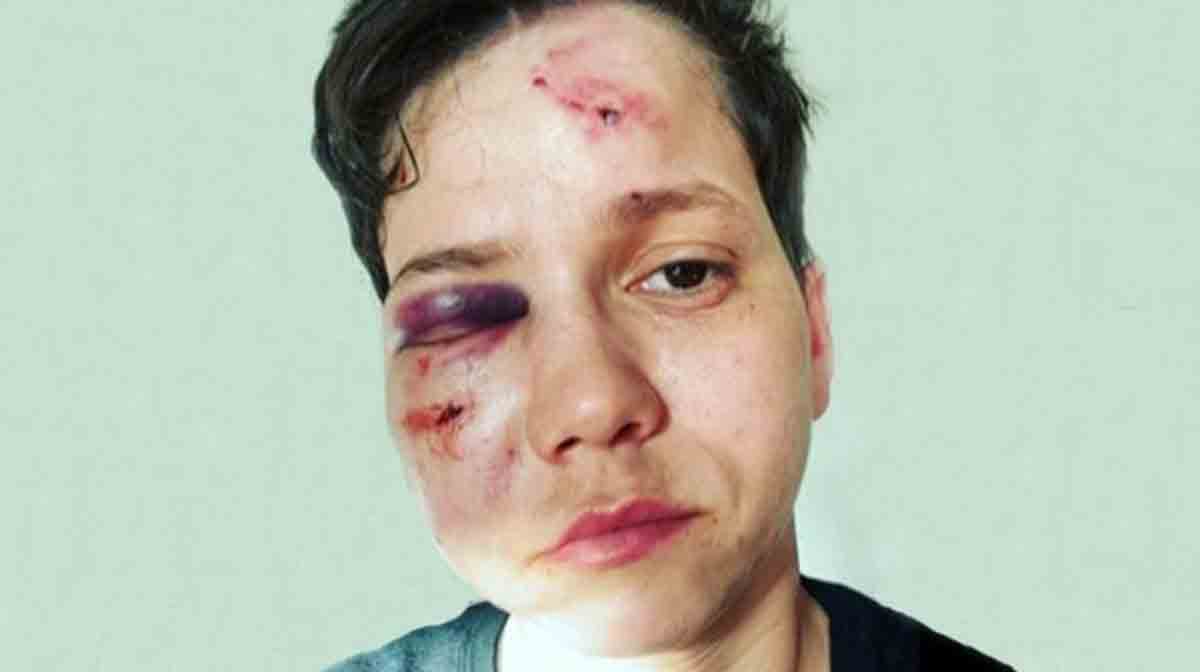 Youtuber bolsonarista é espancada em ataque Homofóbico